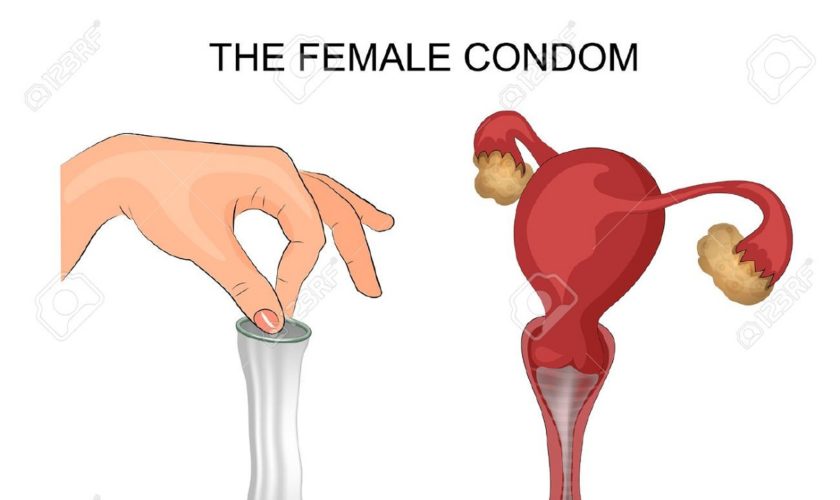 kondom_wanita