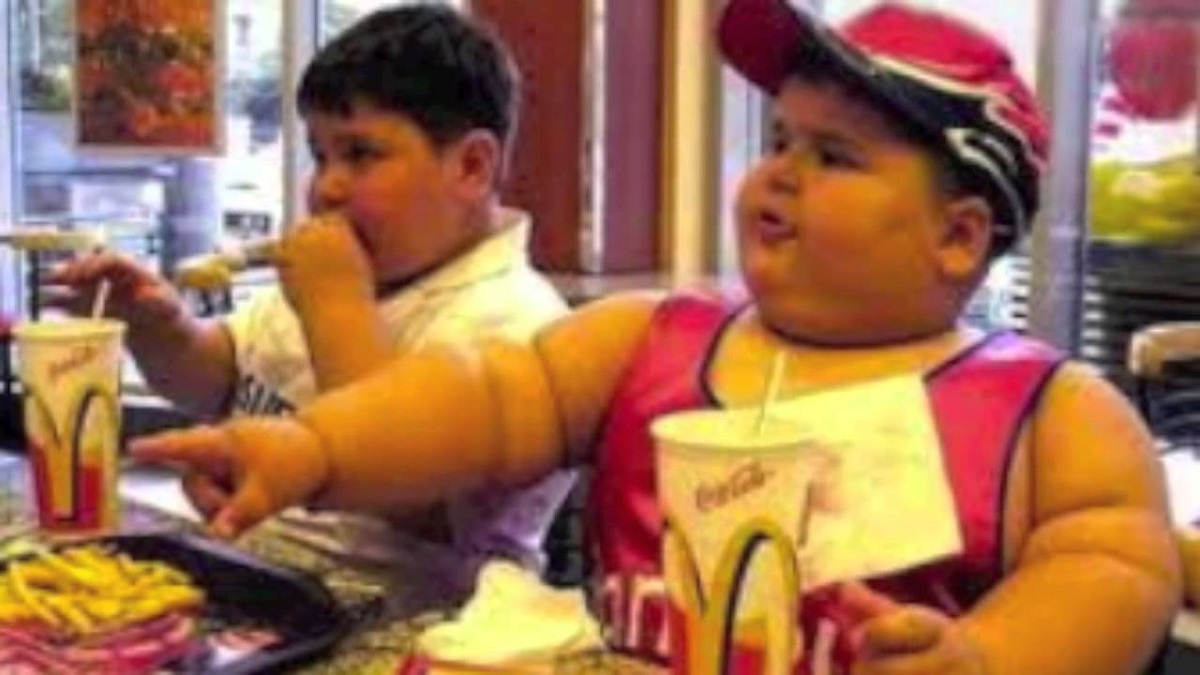 obesitas_pada_anak