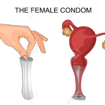 kondom_wanita